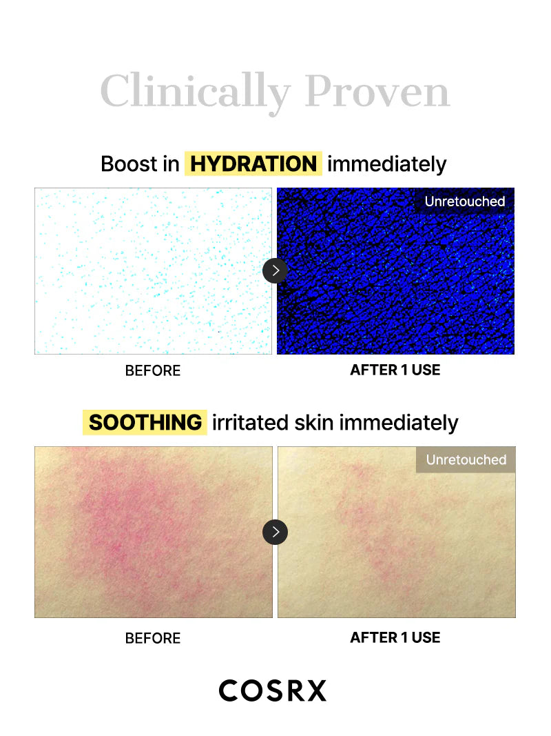 COSRX Glass Glow Hydrogel Mask clinically proven hydration boost and soothing before and after