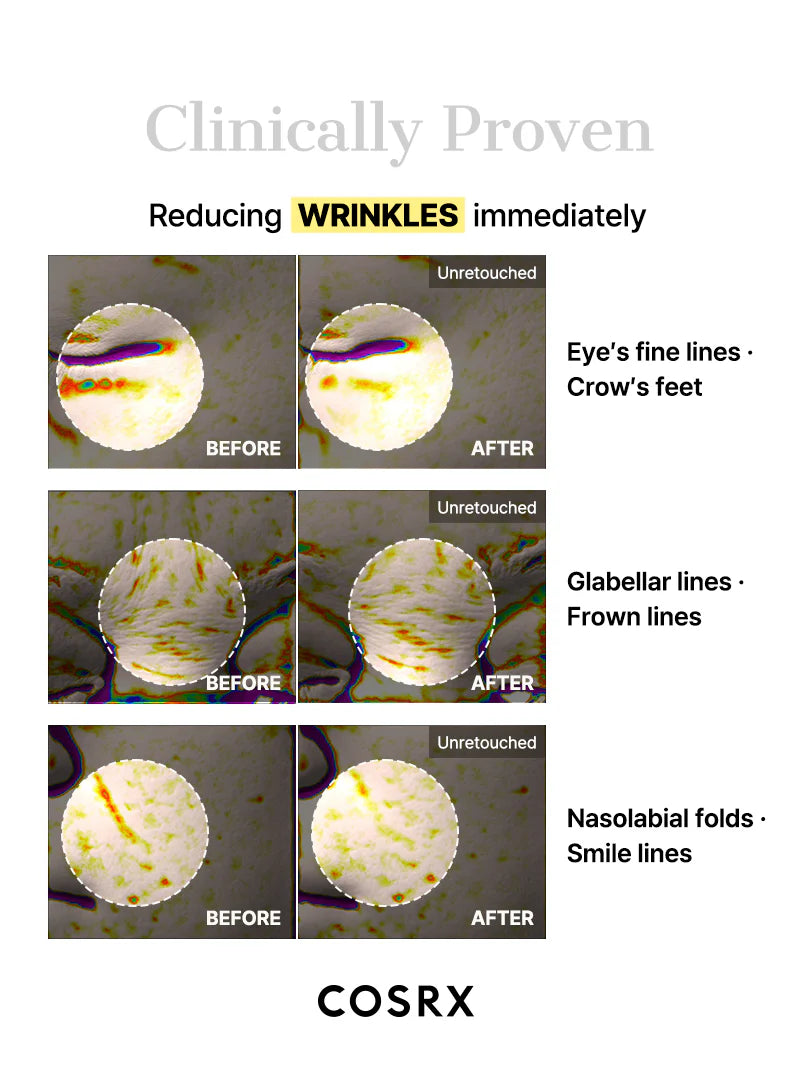 COSRX Glass Glow Hydrogel Mask clinically proven reduction of wrinkles before and after