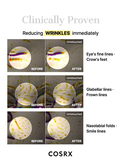 COSRX Glass Glow Hydrogel Mask clinically proven reduction of wrinkles before and after