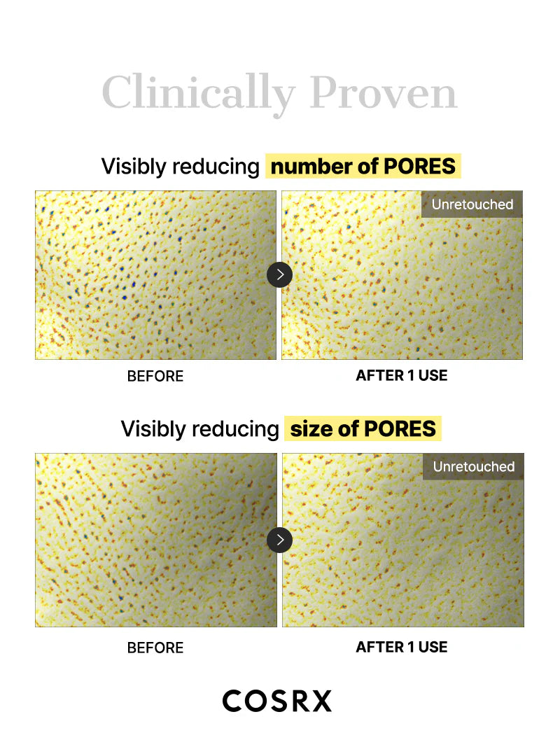 COSRX Snail Mucin Hydrogel Mask clinically proven to reduce pore number and size