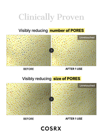 COSRX Snail Mucin Hydrogel Mask clinically proven to reduce pore number and size