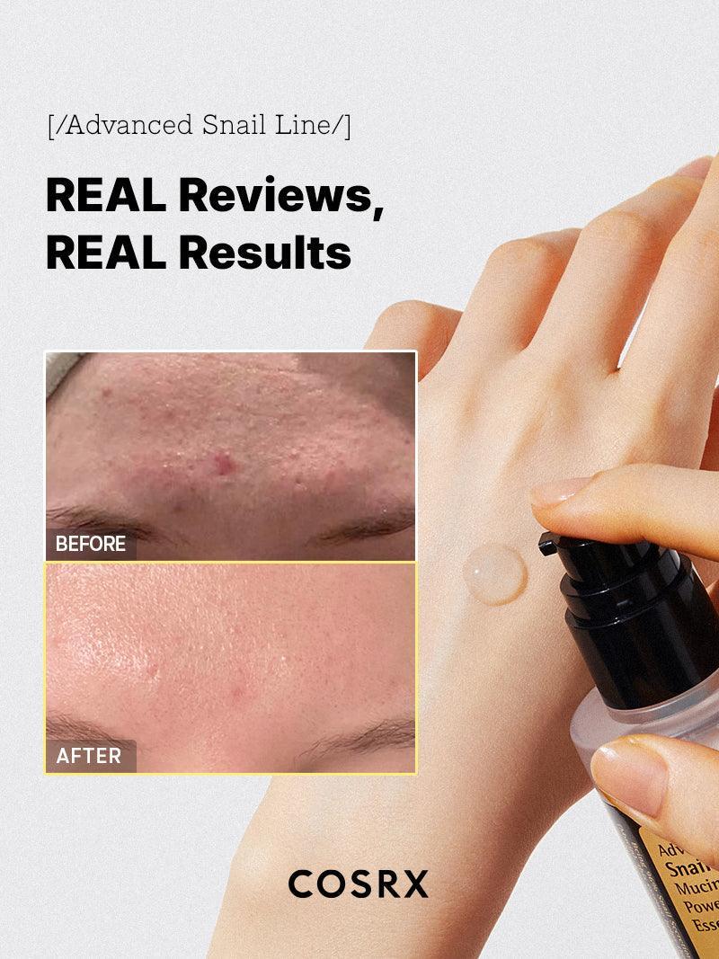 COSRX Advanced Snail 96 Mucin Essence before and after – real skin texture results