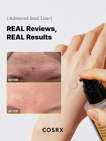 COSRX Advanced Snail 96 Mucin Essence before and after – real skin texture results