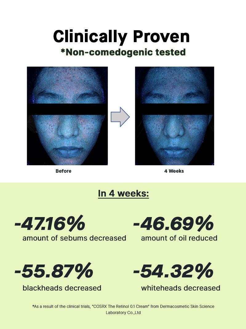 COSRX Retinol 0.1 Cream clinically proven non-comedogenic – reduces sebum and blackheads