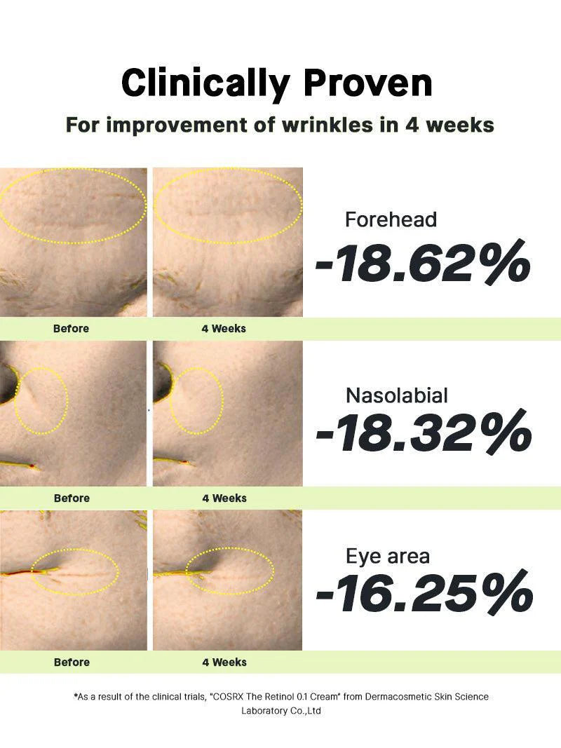COSRX Retinol 0.1 Cream clinically proven wrinkle reduction on forehead, nasolabial and eye area